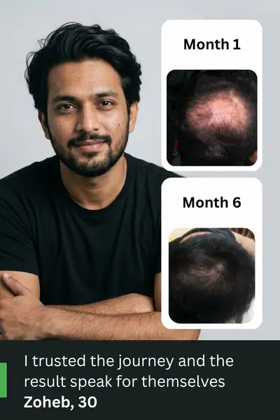 Before-After_Desktop