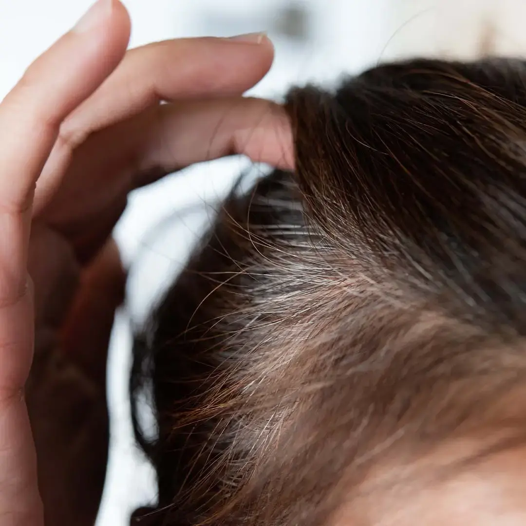 Don’t Panic: Stage-Wise Hair Thinning Routine for Men (2026 Guide)