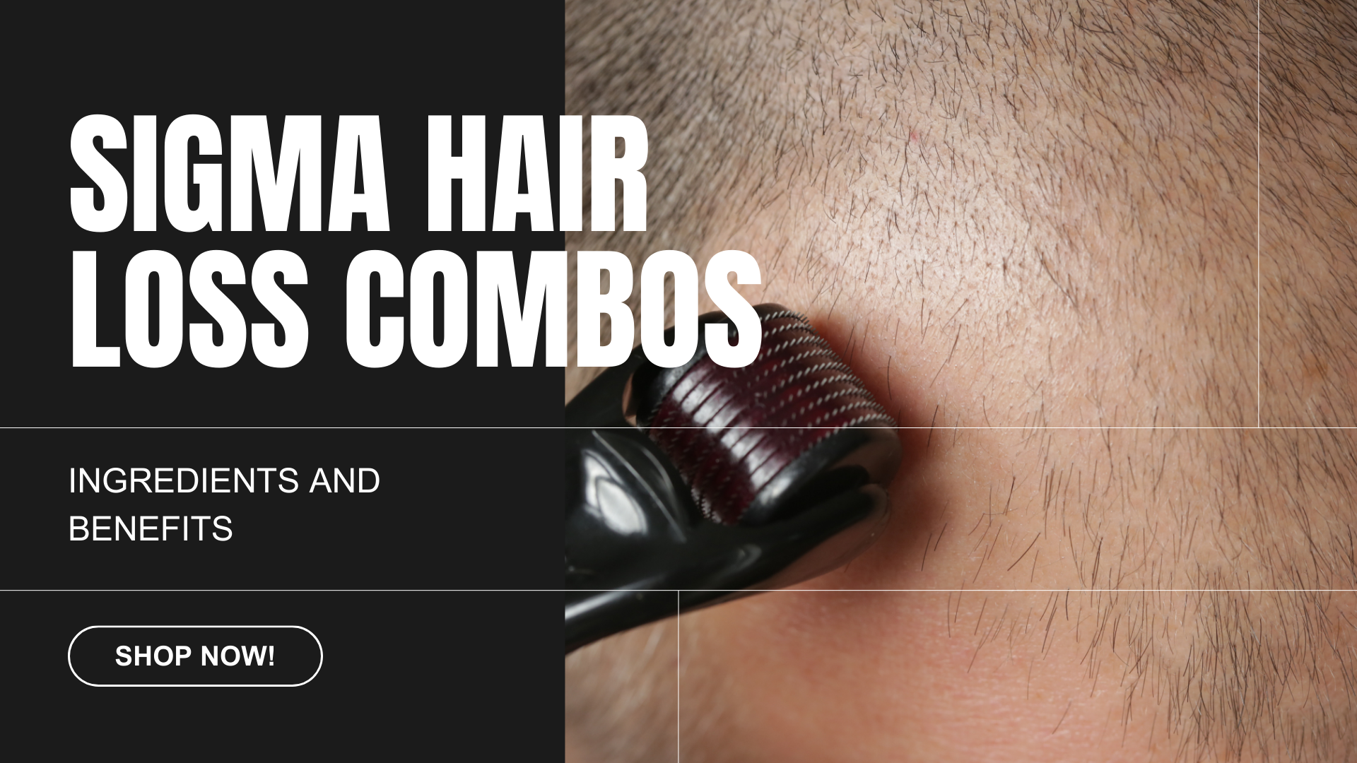The Science Behind Sigma Guys's Hair Loss Combos: Ingredients & Benefits