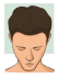 Stage 1 : Hair fall solution