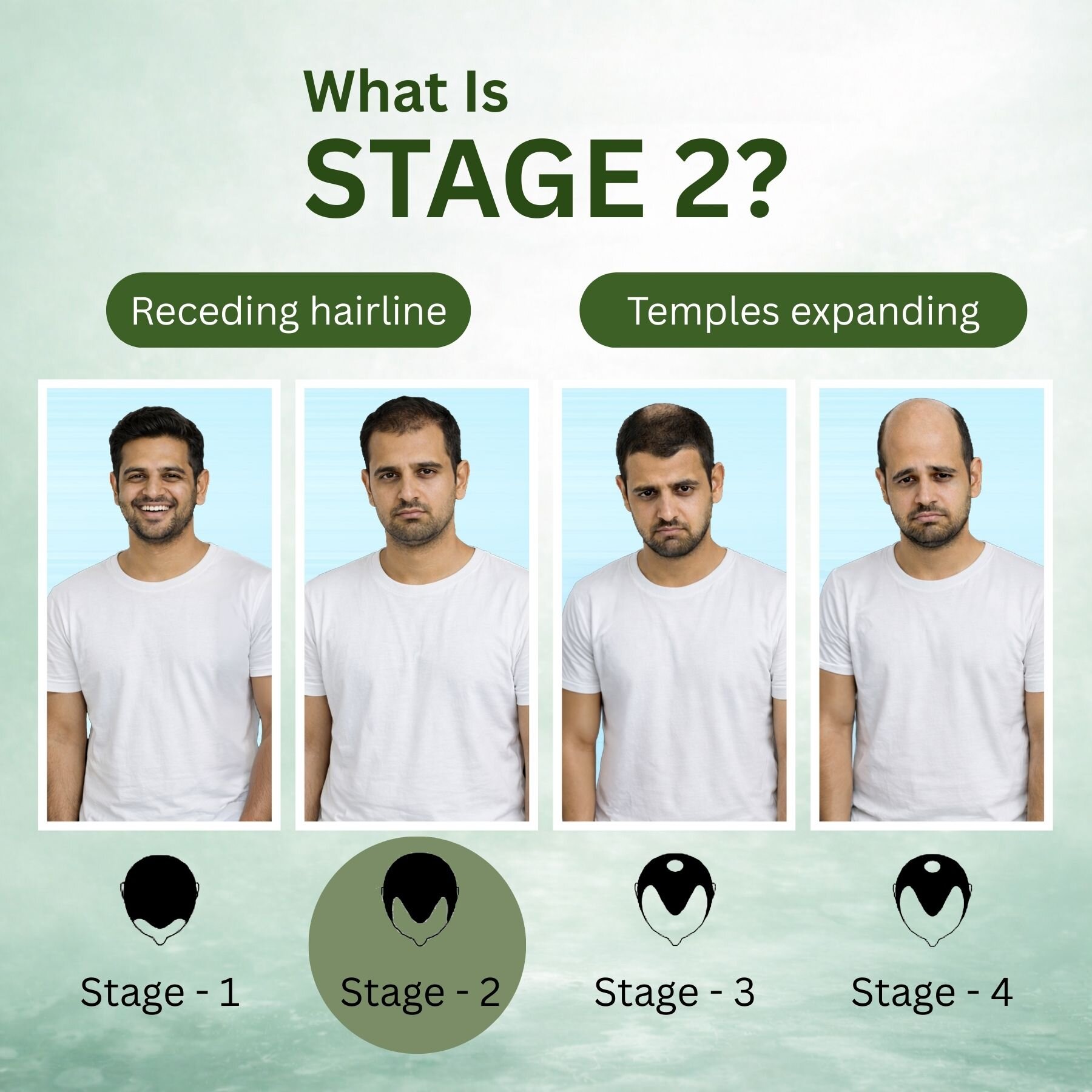 Stage 2 : Hair fall solution