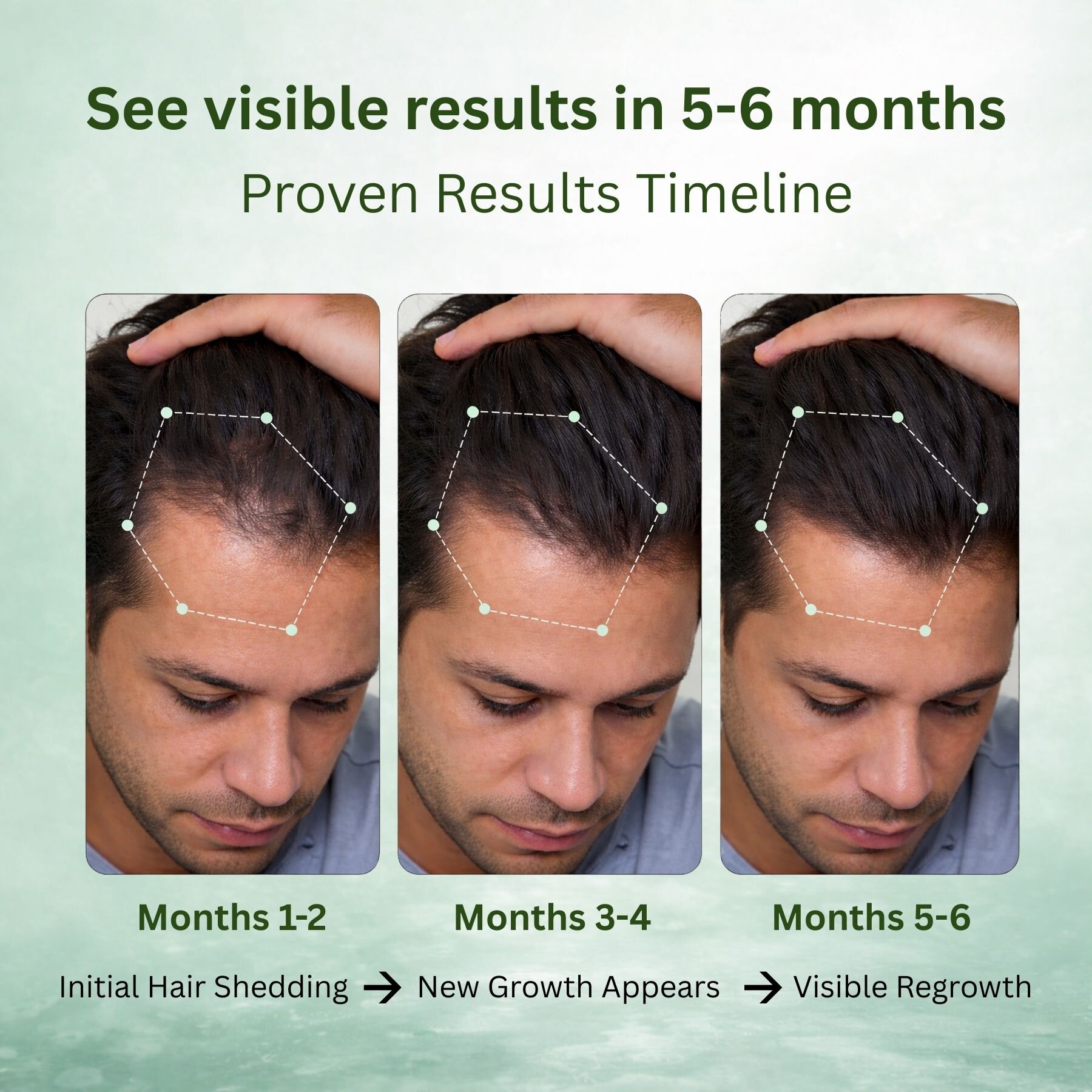 Stage 2 : Hair fall solution