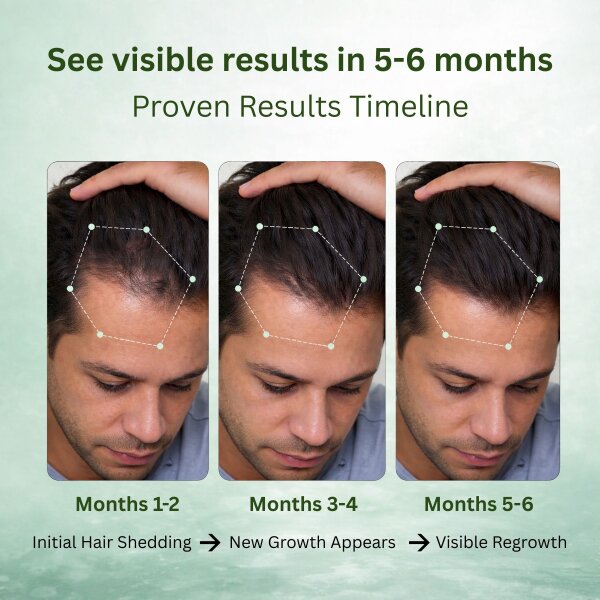 Stage 2 : Hair fall solution