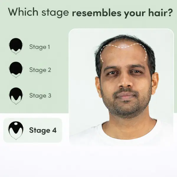 Regrow 10% 60 ml pack