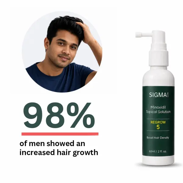 Regrow 5% - Hair Regrowth Spray for Fuller, Thicker Hair