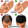 Regrow 5% - Hair Regrowth Spray for Fuller, Thicker Hair