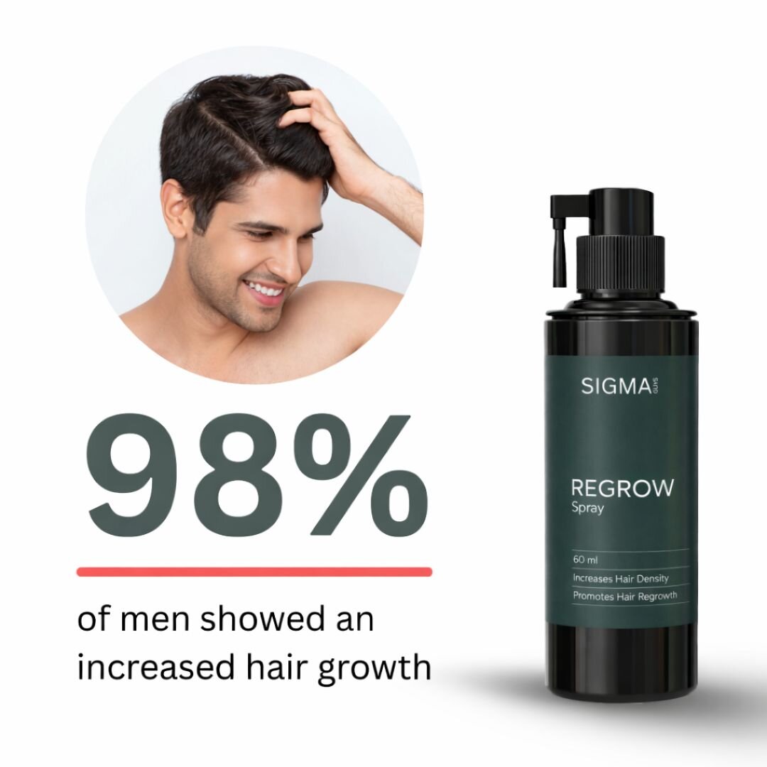 Regrow 5% - Hair Regrowth Spray for Fuller, Thicker Hair