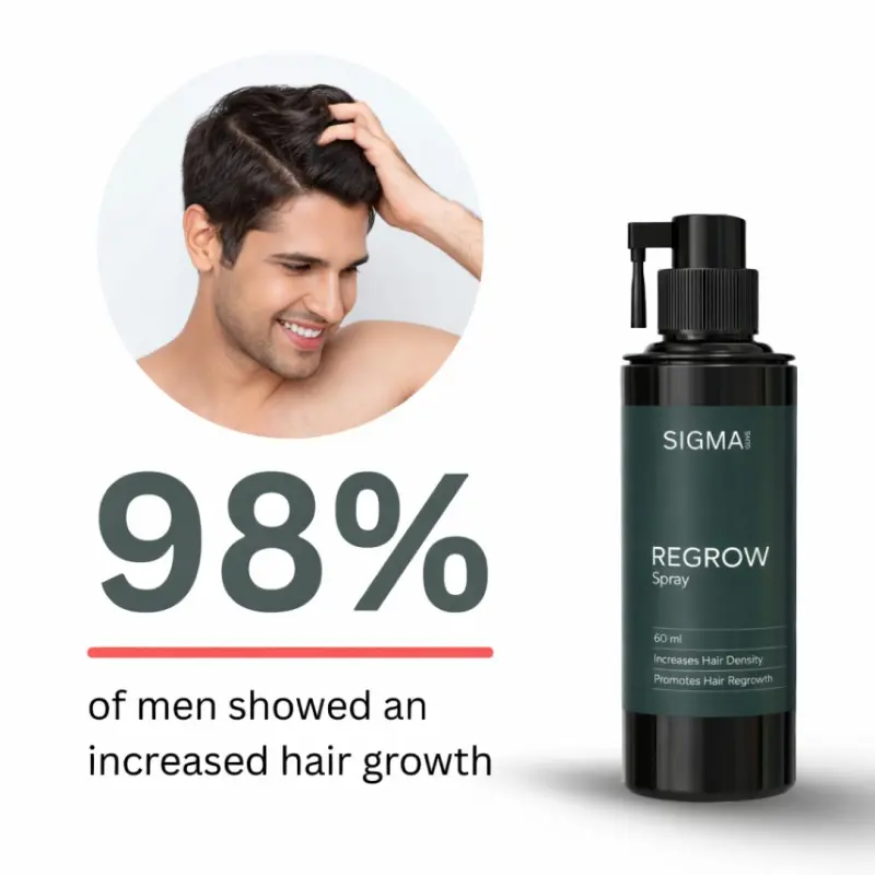 Regrow 5% - Hair Regrowth Spray for Fuller, Thicker Hair