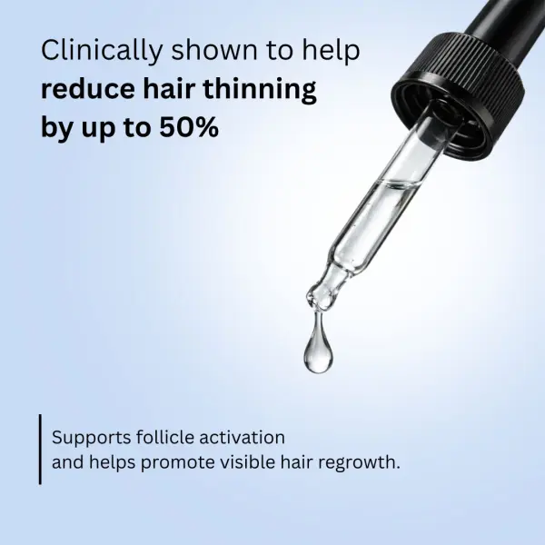 Regrow 5% - Hair Regrowth Spray for Fuller, Thicker Hair