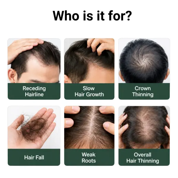 Regrow Maximum Hair Regrowth Kit