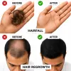 Regrow F10