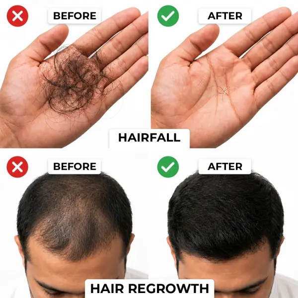 Regrow F5