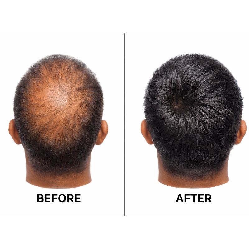 Before-After_Desktop