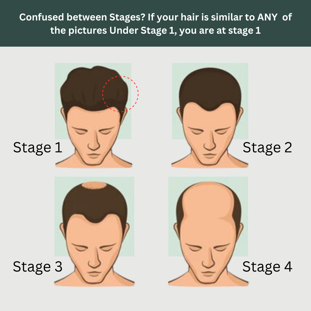 Hair Fall Stage 1: The Starter Kit